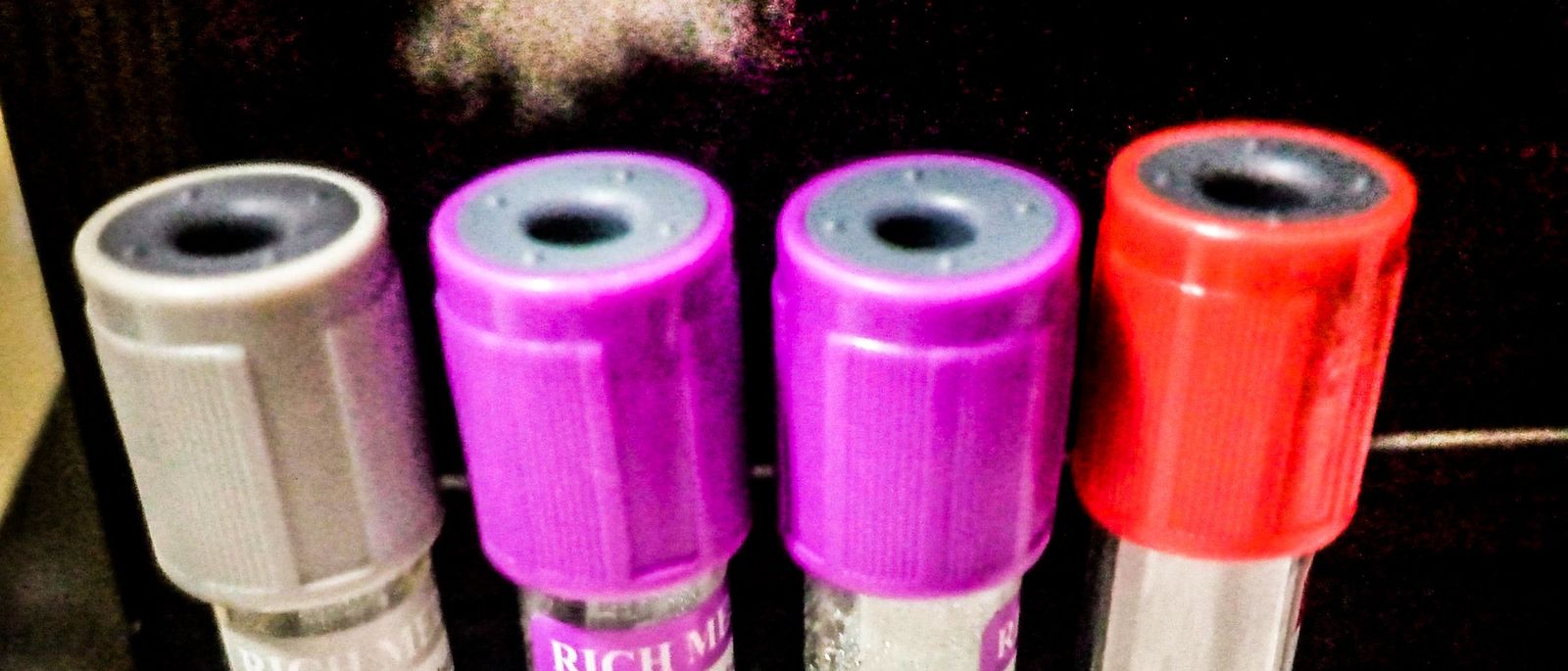 Tabung-tabung sampel darah di laboratorium medis untuk pemeriksaan anemia