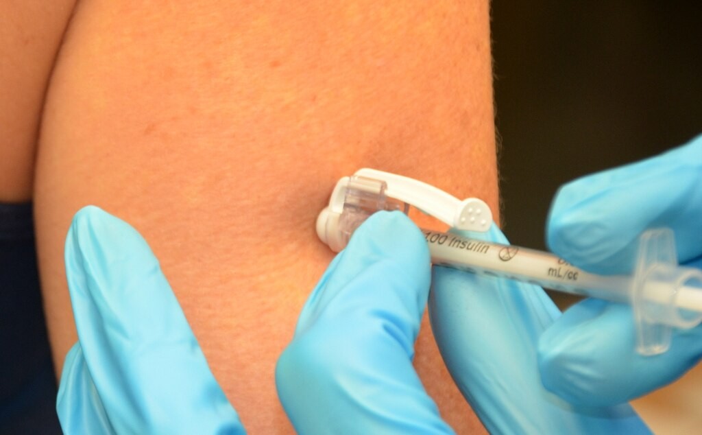 Tenaga medis menyuntikkan insulin menggunakan jarum suntik ke lengan pasien