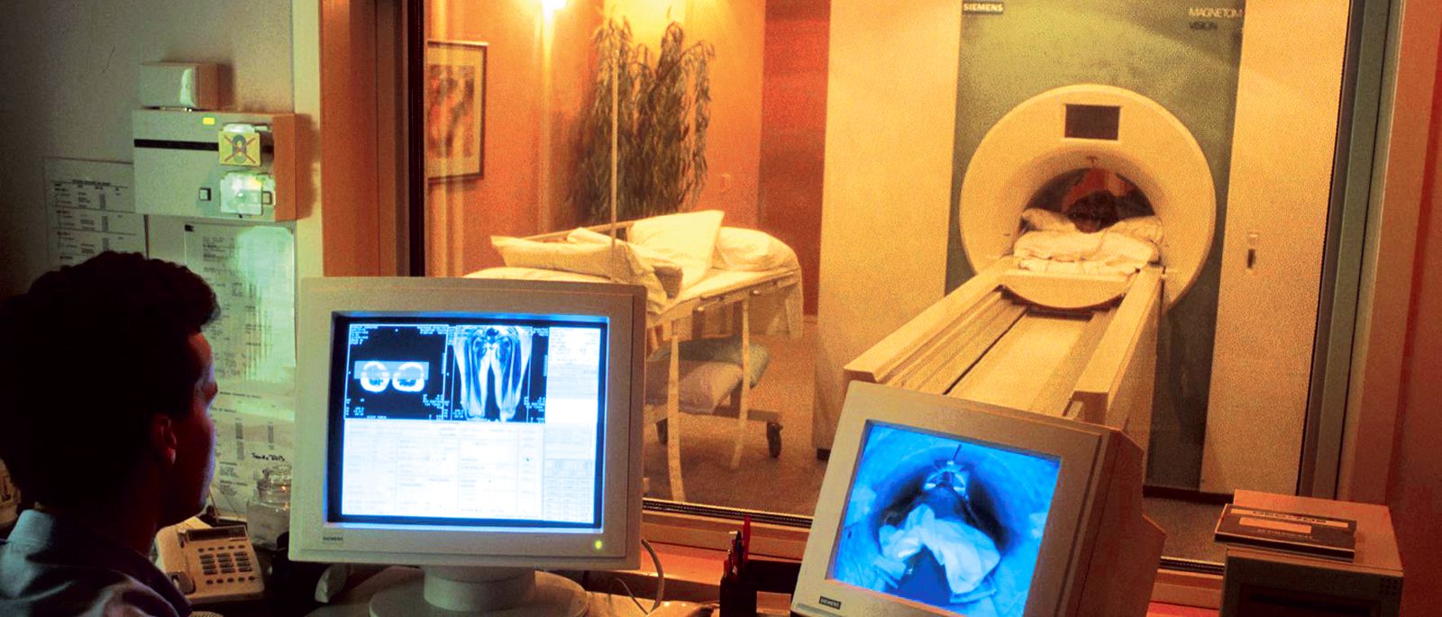 Pasien menjalani pemindaian MRI otak di rumah sakit